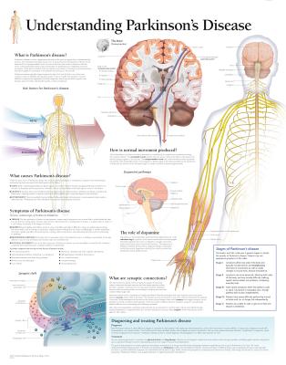 Understanding Parkinson''s Paper Poster
