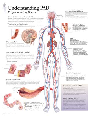 Understanding PAD Laminated Poster