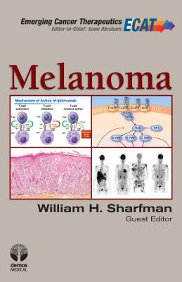 Melanoma