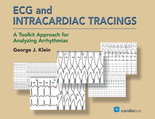 ECG and Intracardiac Tracings