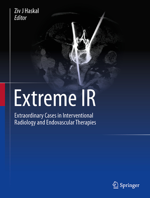 Extreme IR