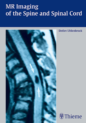 MR Imaging of the Spine and Spinal Cord