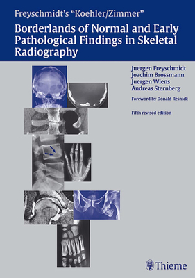 Freyschmidt's "Koehler/Zimmer" Borderlands of Normal and Early Pathological Findings in Skeletal Radiography