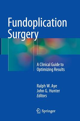 Fundoplication Surgery