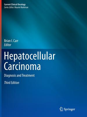 Hepatocellular Carcinoma