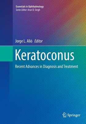 Keratoconus