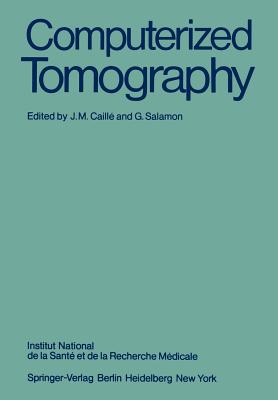 Computerized Tomography
