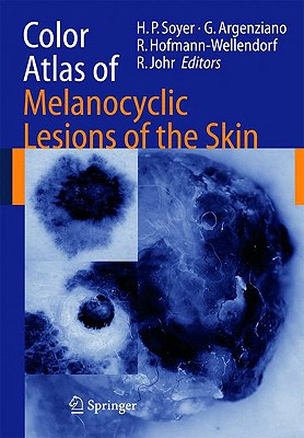 Color Atlas of Melanocytic Lesions of the Skin