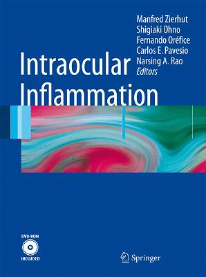 Intraocular Inflammation