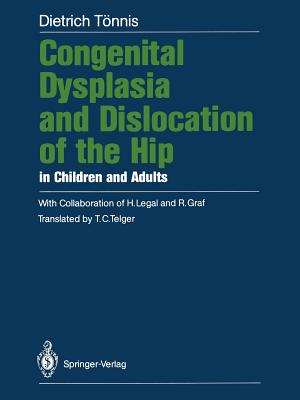 Congenital Dysplasia and Dislocation of the Hip in Children and Adults