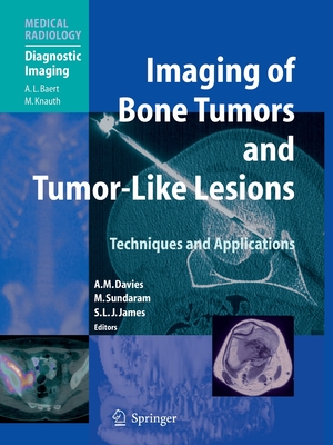 Imaging of Bone Tumors and Tumor-Like Lesions