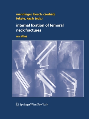 Internal fixation of femoral neck fractures