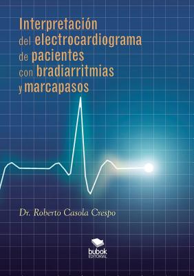 Interpretacion del electrocardiograma de pacientes con bradiarritmias y marcapasos