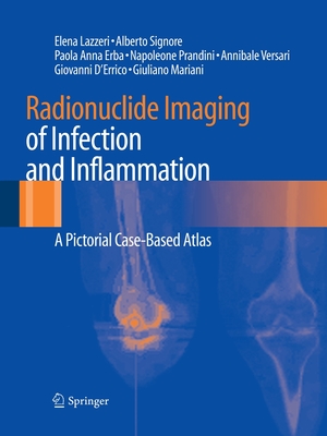 Radionuclide Imaging of Infection and Inflammation