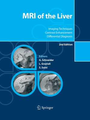 MRI of the Liver