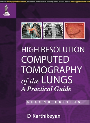 High Resolution Computed Tomography of the Lungs: A Practical Guide