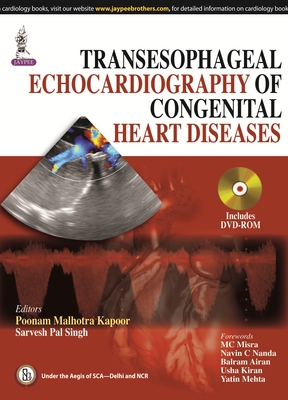 Transesophageal Echocardiography of Congenital Heart Diseases