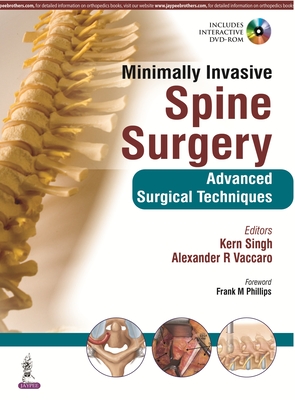 Minimally Invasive Spine Surgery