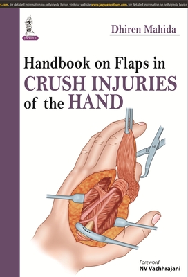 Handbook on Flaps in Crush Injuries of the Hand