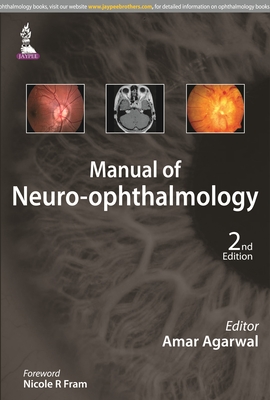 Manual of Neuro-ophthalmology