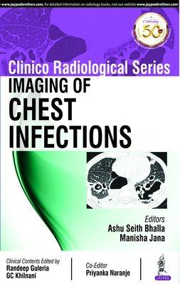 Clinico Radiological Series: Imaging of Chest Infections