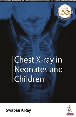 Chest X-ray in Neonates and Children