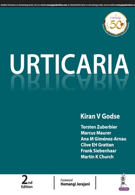 Urticaria