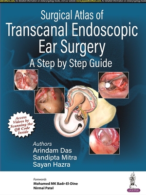 Surgical Atlas of Transcanal Endoscopic Ear Surgery