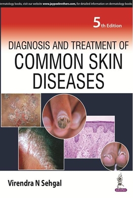 Diagnosis and Treatment of Common Skin Diseases