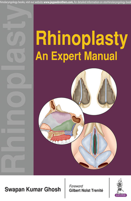 Rhinoplasty