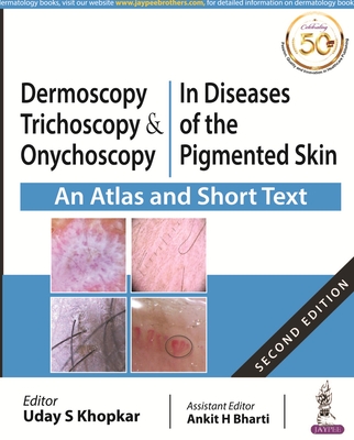 Dermoscopy, Trichoscopy and Onychoscopy in Diseases of the Pigmented Skin