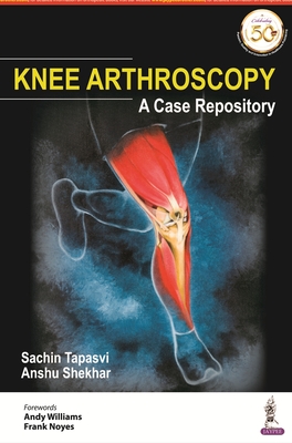 Knee Arthroscopy