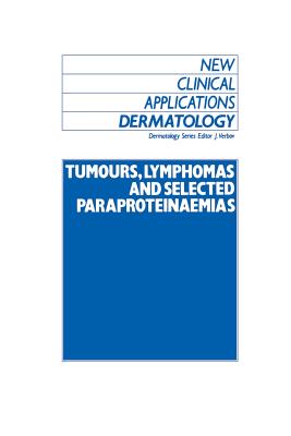 Tumours, Lymphomas and Selected Paraproteinaemias